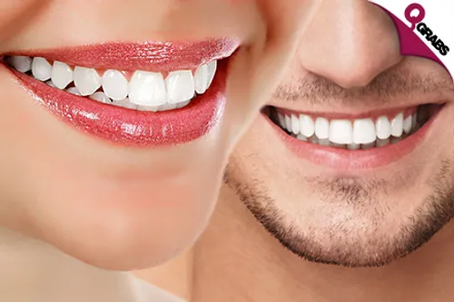 From QR120 Care for your Pearly Whites with Fluoride Treatment OR Teeth Whitening OR Closed Curettage OR Hollywood Smile! (Up to QR3500 Value)